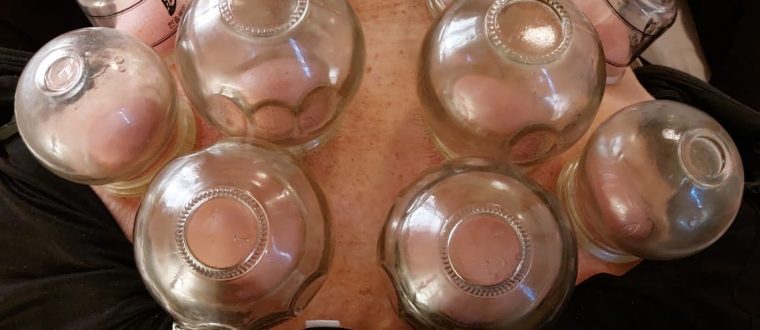 Cupping Therapy Health Benefits